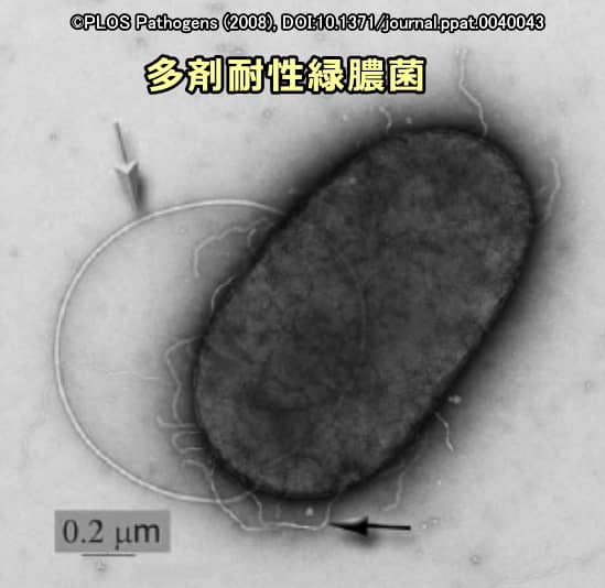 多剤耐性緑膿菌の顕微鏡写真